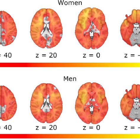 Lesion Overlap Maps For Women And Men Spatial Correlation Between The