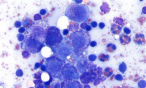 Use This Image Gallery To Review Common Cytologic Findings Of Lymph