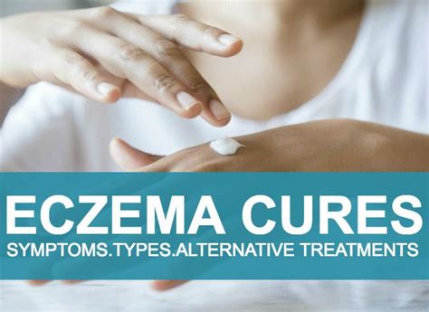 Eczema And Dermatitis Are Synonyms For A Disease That Is The Most