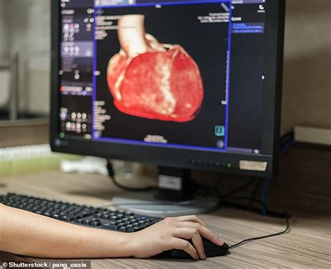 Thousands Are Missing Out On Vital Heart Scans Doctors Warn Daily