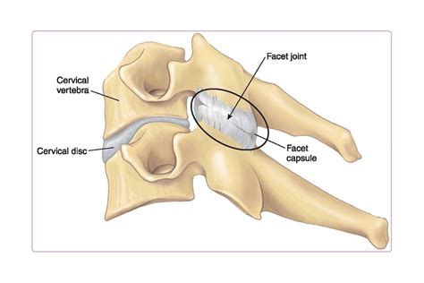 Cervical Facet Joint Anatomy Hot Sex Picture