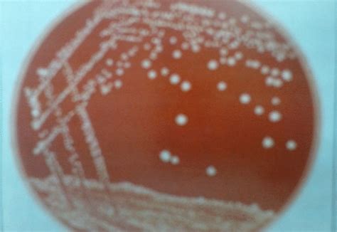 Pasteurella infections result in pneumonia along with septicemia, arthritis, and otitis media. Growth of Pasteurella multocida over Blood agar base ...