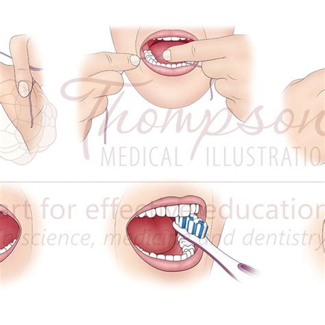 endocrine disorders illustration by thompson medical illustration medical illustration and animation