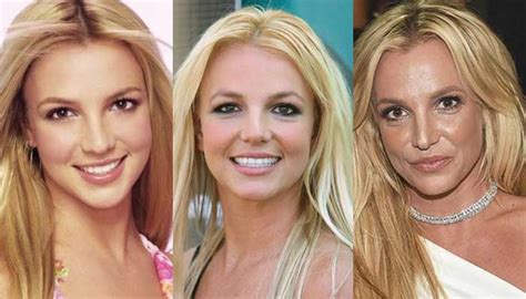 Britney Spears Plastic Surgery 2023 Famousfaceshub