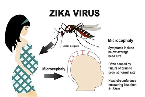 Tipps Gegen Das Zika Virus Medmix