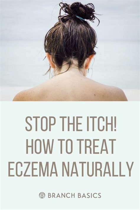 Stop The Itch How To Treat Eczema Naturally How To Treat Eczema