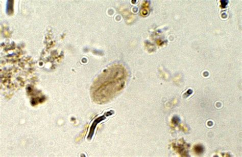 Giardia Lamblia Cyst Parasitology
