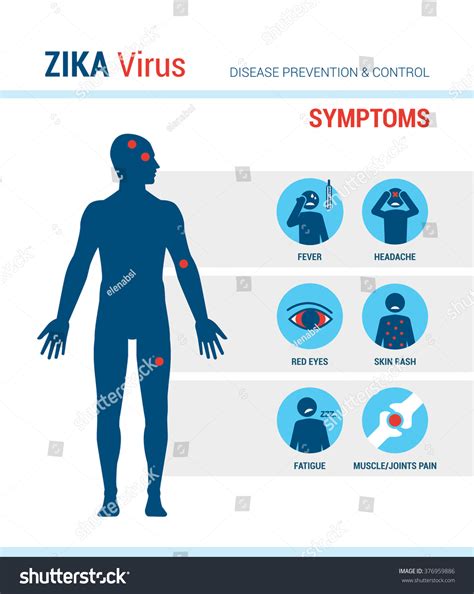 Zika Virus Symptoms Infographics With Stick Figures And Text Stock