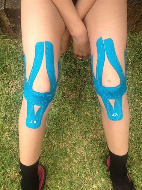 Often times it is a condition seen in younger people who are growing rather quickly. 168 best images about Athletic KT Taping on Pinterest ...