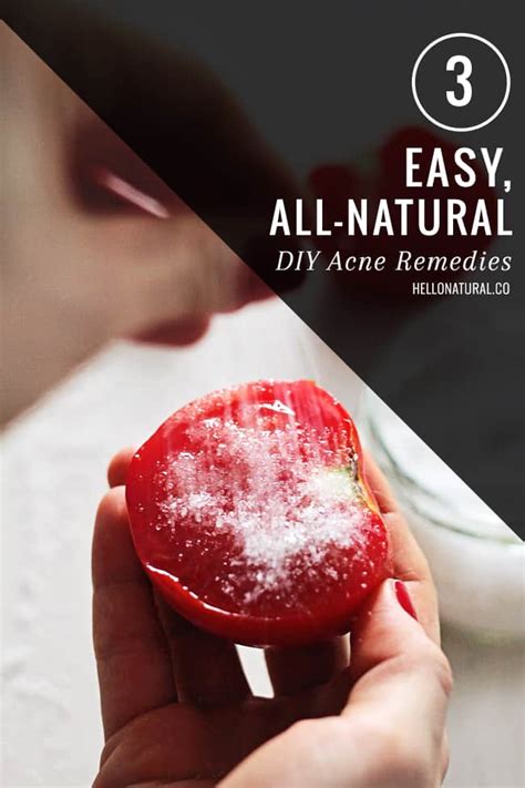 3 Easy All Natural Diy Acne Remedies