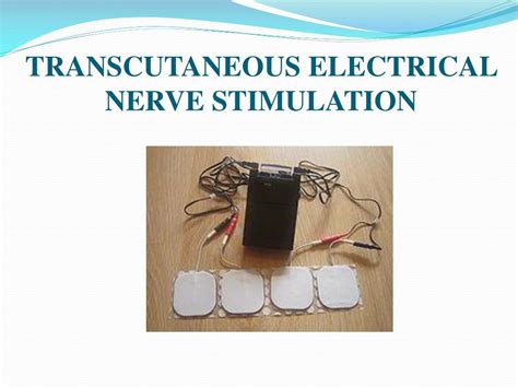 Ppt Transcutaneous Electrical Nerve Stimulation Powerpoint