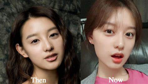 However, that doesn't seem to be the case. Kim Ji Won Plastic Surgery Before and After Photos ...