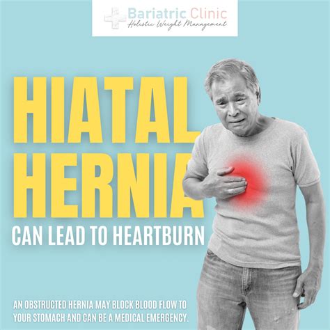 Hiatal Hernia Bariatric Clinic Singapore