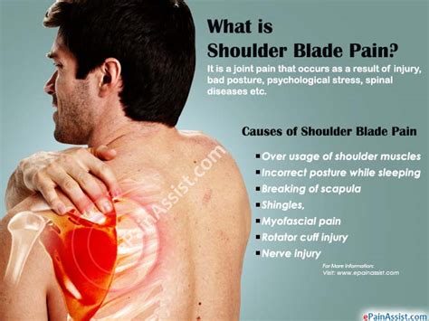 Pain In Left Shoulder Blade And Arm Eliminate Shoulder Blade And