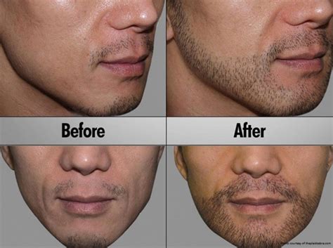 How to grow a moustache. Home remedies to make your beard grow faster. | Netmarkers ...