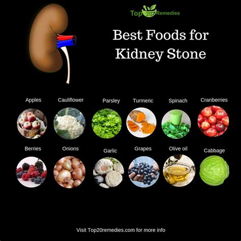 Symptoms include severe lower back the risk of kidney stones is about 11% in men and 9% in women. How to remove gallstones with home remedies | Essential ...