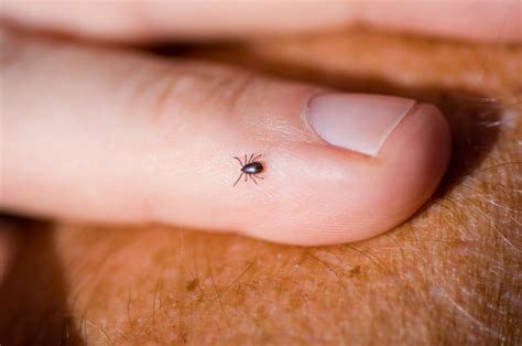 Lyme Disease Should You Be Worried About Ticks