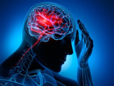 Encuentra las últimas noticias de muerte cerebral: Essential facts on stroke