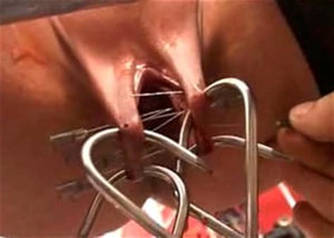 Needle Pain BDSM Extreme Tit Torture Pussy Torture TG Page 4