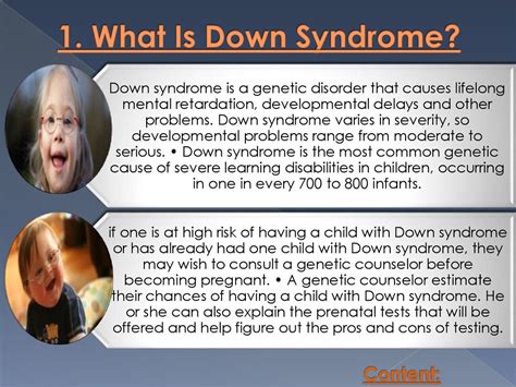 What Is Down Syndromecommon Symptoms Online Presentation
