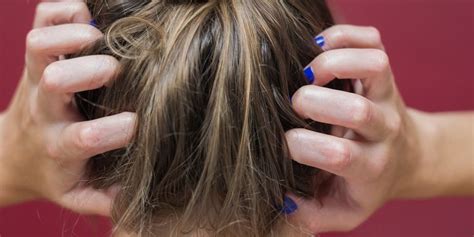 10 Reasons Your Scalp Might Be Itchy — And What To Do About It Itchy