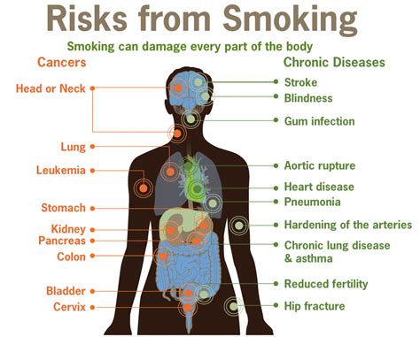 Lung Cancer Risks Prevention And Early Detection 50 World 50 World