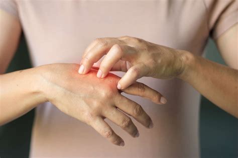 Artritis Psoriatica En Griep Med Nl