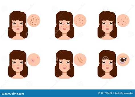 Woman With Skin Problem Acne Vector Stock Vector Illustration Of