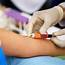 What To Expect During A Blood Test  South Florida Healthcare Blog