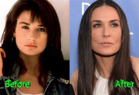 Demi Moore Plastic Surgery Gone Too Far