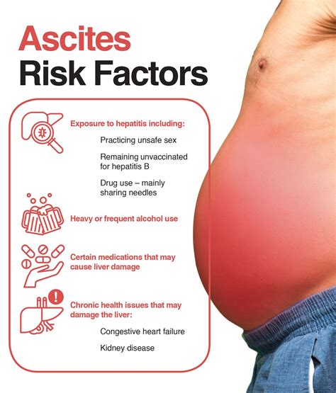 Ascites Causes