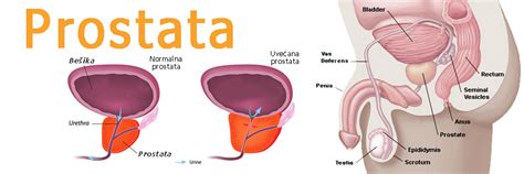 Rak Prostate Preti Mu Kom Delu Populacije