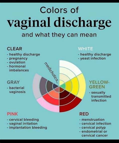 Vaginal Discharge Medizzy