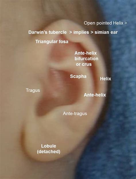 Ear Landmarks Clinical Eye Openers