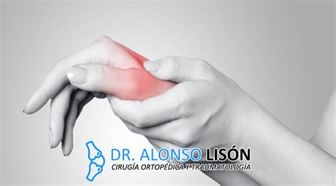 La Importancia Del Dedo Pulgar Traumatólogo Murcia Doctor Alonso Lisón