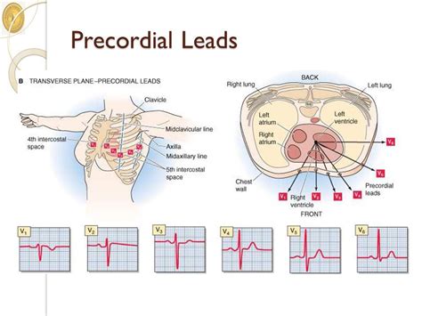 Precordial Leads Medical Knowledge Ekg Interpretation Cardiac Cycle