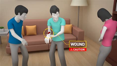 Safe Steps First Aid Severe Bleeding Youtube