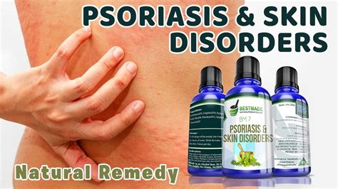 Psoriasis And Skin Disorders Natural Remedy By Bestmade Natural Products