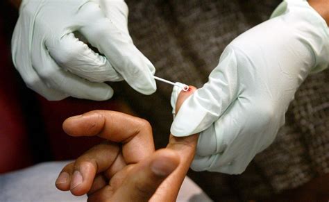 A finger stick blood test is used, and results are available in the same visit. Bill aimed to make HIV testing easier passes Senate ...