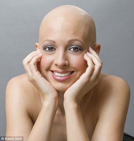 I Started Going Bald At Now I Want To Show The World That Women With Hair Lo Erofound