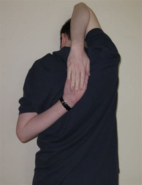 Shoulder Hypermobility A Reluctant Contortionist