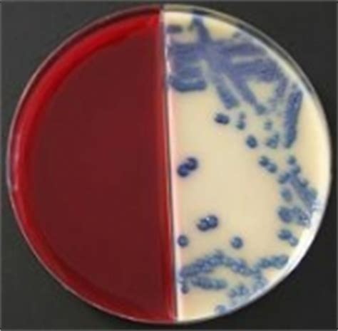 Used to specifically grow gram positive organisms such as staphylococci, streptococci and enterococci. mibius - COLUMBIA-CNA-ÄSCULIN-NB/BRILLIANCE (TM) UTI - 10 ...