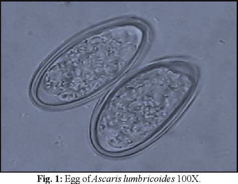 Enterobius Vermicularis Egg