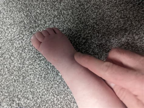 Bad Circulation Purple Feet Mumsnet