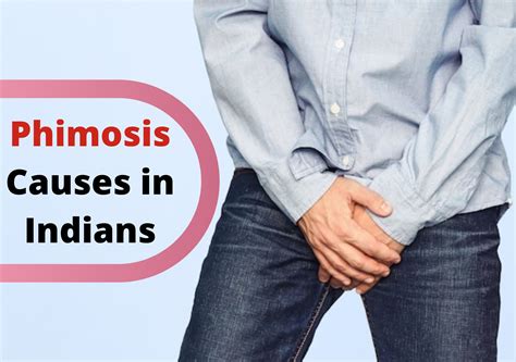 Causes Of Phimosis In Indians Urolife Clinic
