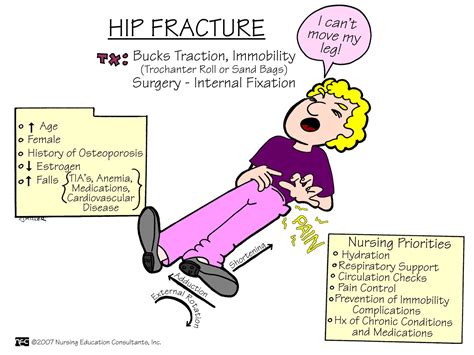 The 25 Best Hip Fracture Ideas On Pinterest Types Of