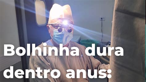 Bolinha Roxa No Anus