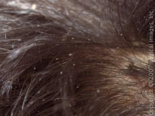 For those who have blonde hair, this is how it looks like. Superfluous Miscellany: A Completely Different Subject ...