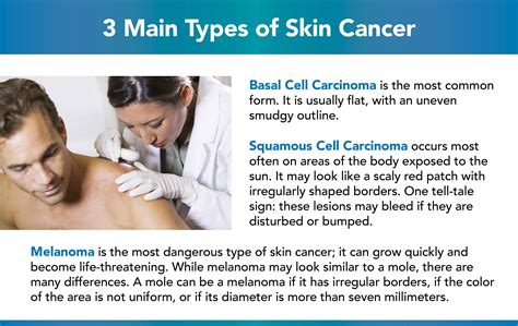 Types Of Skin Cancer Kinds And Forms Of Skin Cancers Kulturaupice