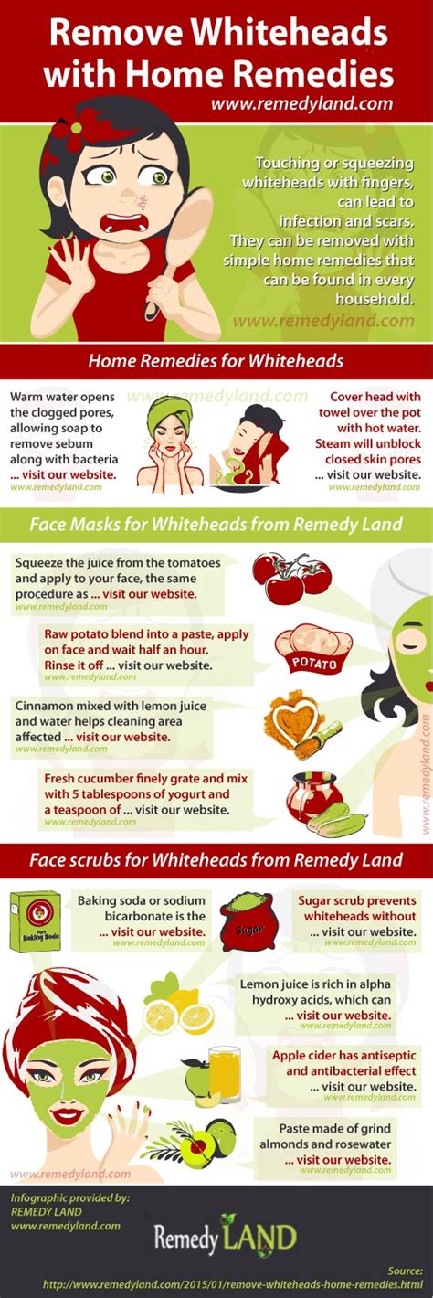 Remove Whiteheads With Home Remedies Remedy Land